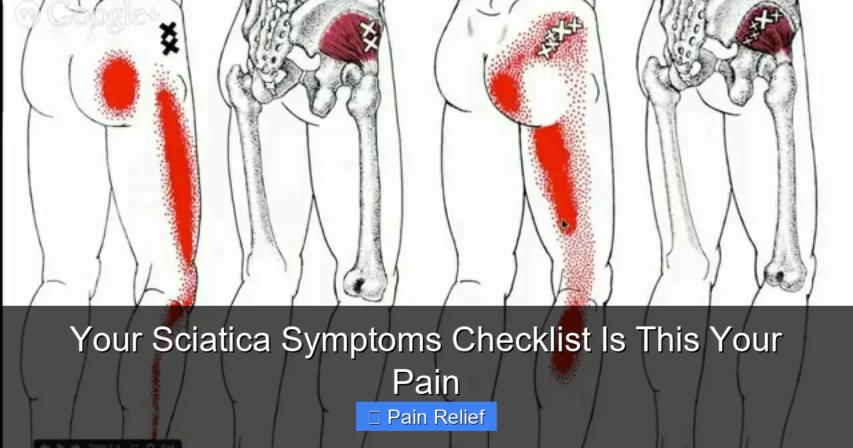 Your Sciatica Symptoms Checklist Is This Your Pain