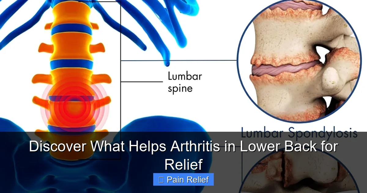 Discover What Helps Arthritis in Lower Back for Relief