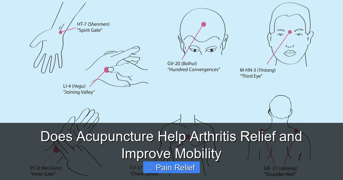 Does Acupuncture Help Arthritis Relief and Improve Mobility