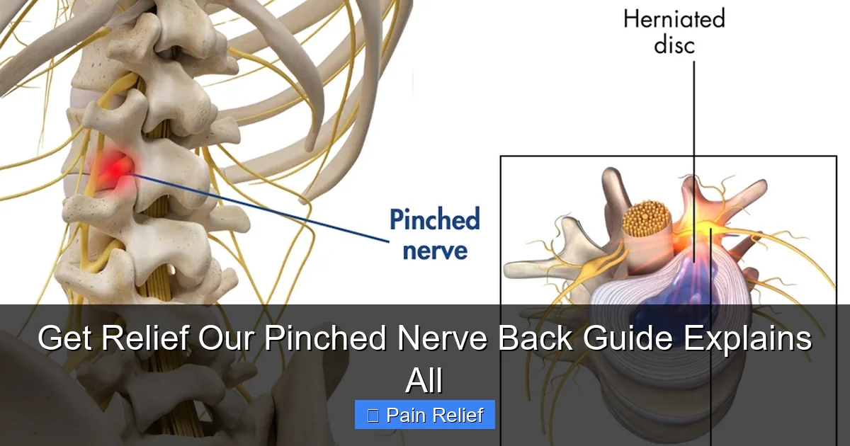 Get Relief Our Pinched Nerve Back Guide Explains All