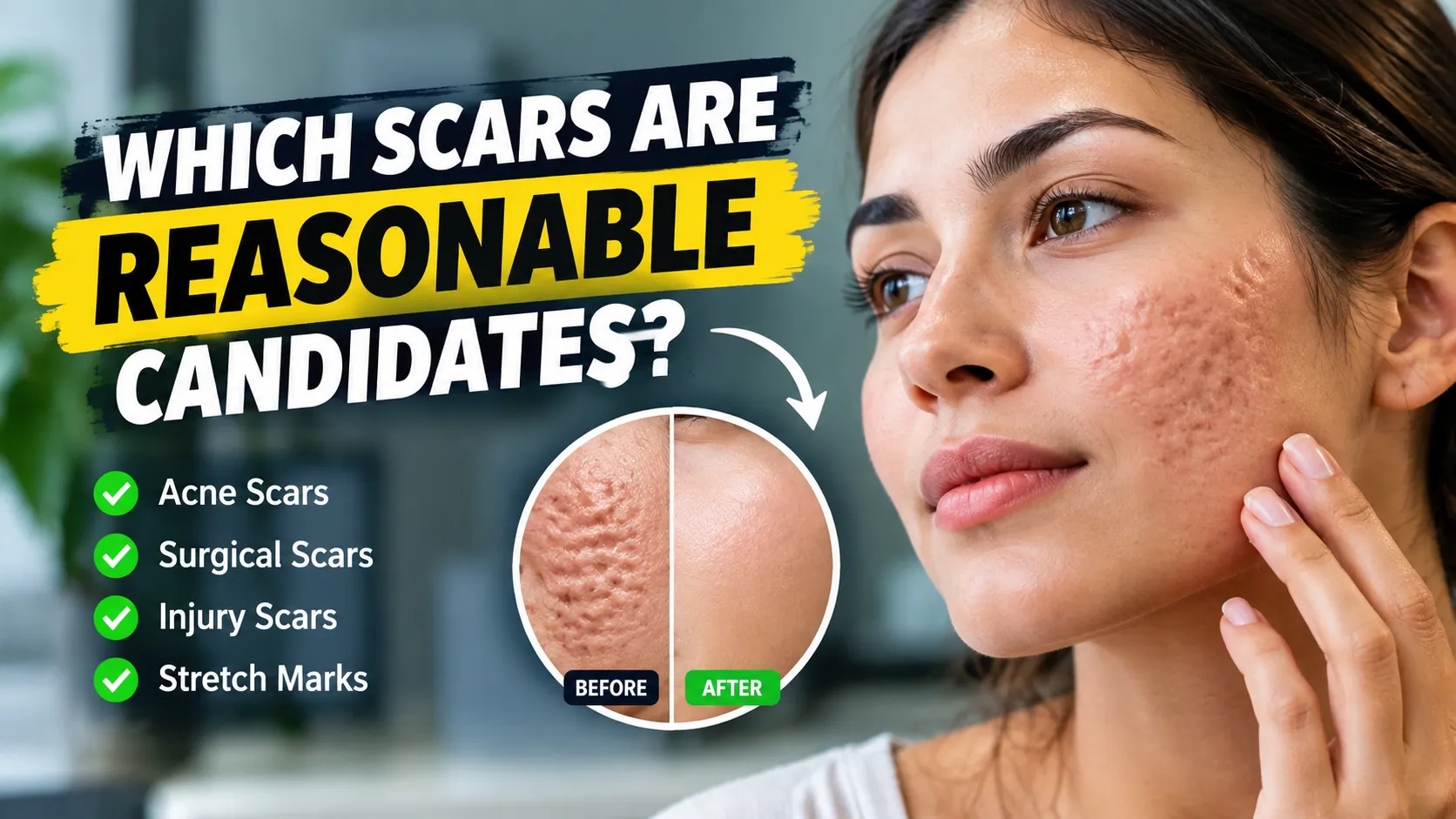 Which Scars Are Reasonable Candidates